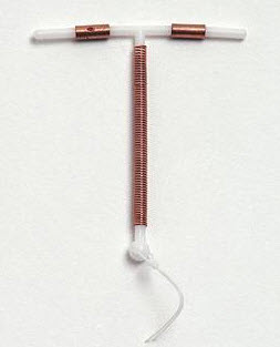 An intrauterine device.